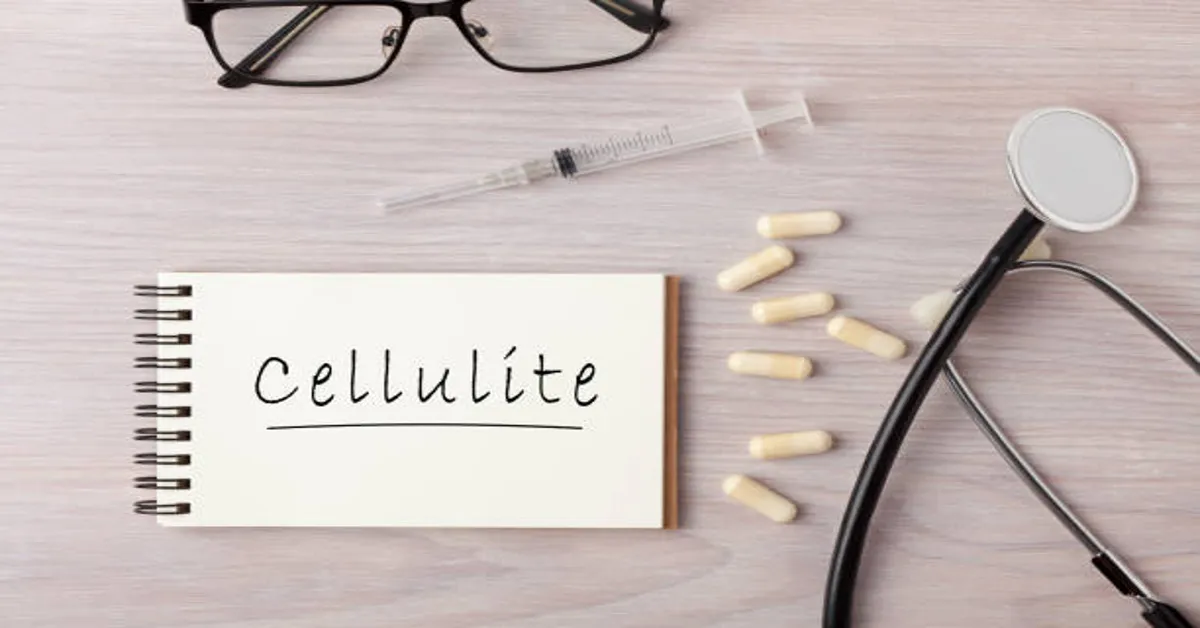 Cellulogia