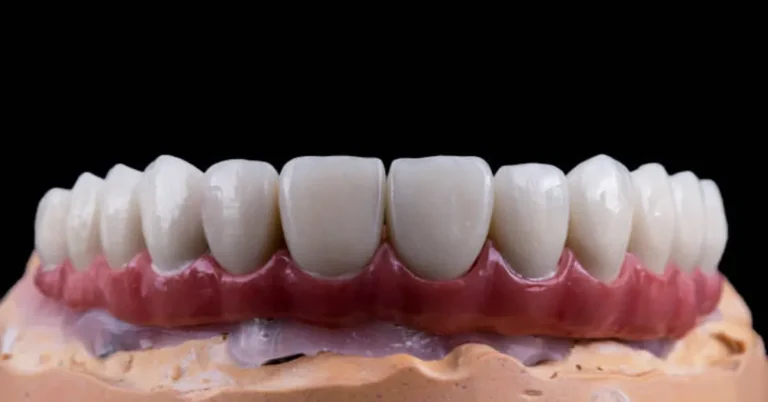 Ceramic Teeth Cap
