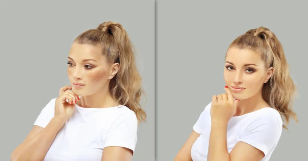 Masseter Botox Before and After